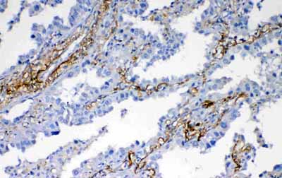 2 - Anti-VEGFD Picoband Antibody ABO12555