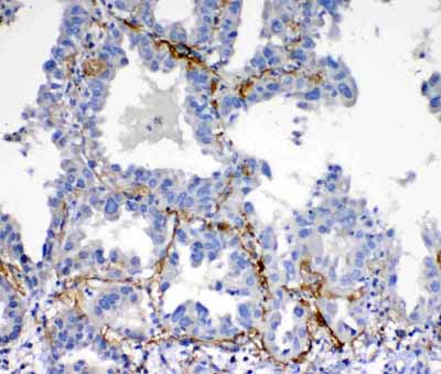 2 - Anti-VEGFD Picoband Antibody ABO12555