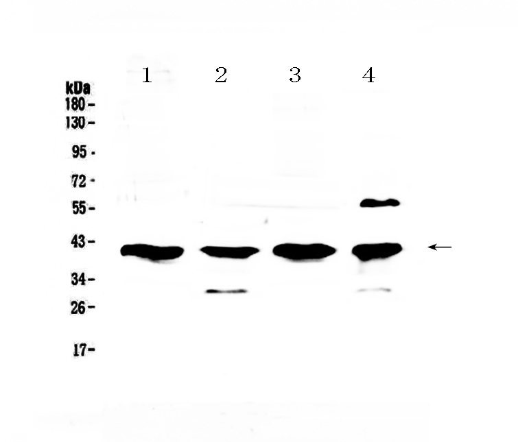 1 - Anti-VEGFD Picoband Antibody ABO12555