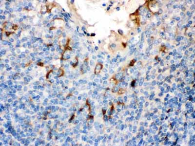 2 - Anti-Filaggrin Picoband Antibody ABO12556