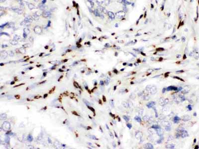 2 - Anti-MDMX Picoband Antibody ABO12558