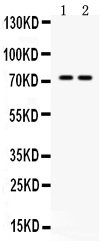 1 - Anti-MDMX Picoband Antibody ABO12558