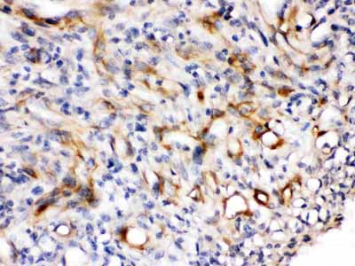 2 - Anti-Nestin Picoband Antibody ABO12560