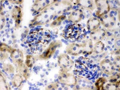 2 - Anti-Nestin Picoband Antibody ABO12560