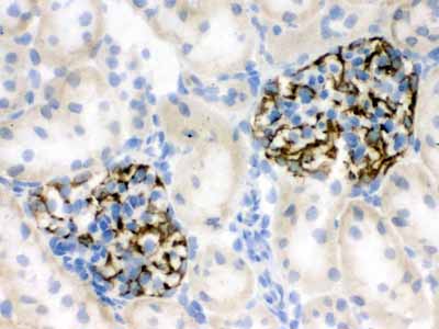2 - Anti-Nestin Picoband Antibody ABO12560