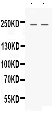 1 - Anti-Nestin Picoband Antibody ABO12560