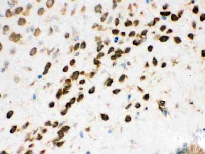 2 - Anti-nmt55/p54nrb Picoband Antibody ABO12561