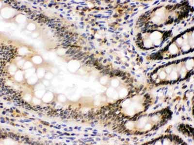 2 - Anti-nmt55/p54nrb Picoband Antibody ABO12561