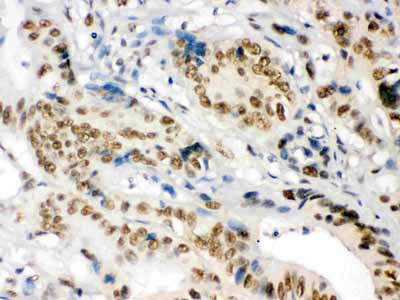 2 - Anti-nmt55/p54nrb Picoband Antibody ABO12561