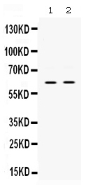 1 - Anti-PAK3 Picoband Antibody ABO12563
