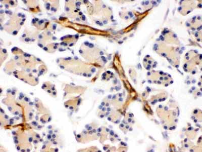 2 - Anti-DARPP32 Picoband Antibody ABO12565