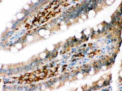 2 - Anti-DARPP32 Picoband Antibody ABO12565