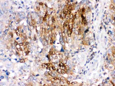 2 - Anti-DARPP32 Picoband Antibody ABO12565