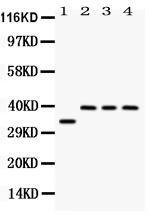 1 - Anti-DARPP32 Picoband Antibody ABO12565