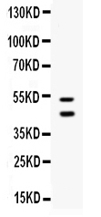 1 - Anti-EPCR Picoband Antibody ABO12566