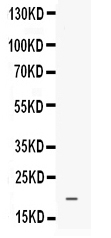 1 - Anti-EG-VEGF Picoband Antibody ABO12567