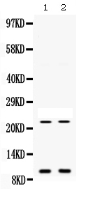 1 - Anti-EG-VEGF Picoband Antibody ABO12568