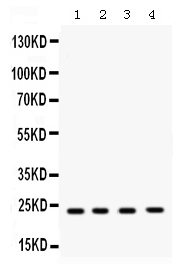 1 - Anti-RAB7 Picoband Antibody ABO12569