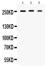 1 - Anti-Scn1a Picoband Antibody ABO12573