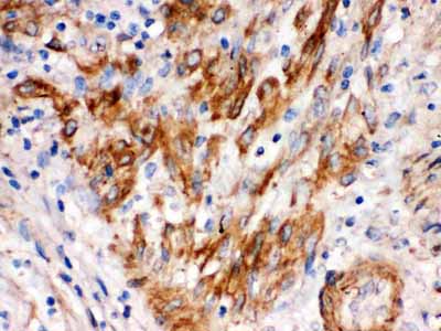 2 - Anti-SFRP4 Picoband Antibody ABO12574