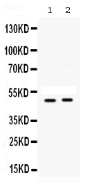 1 - Anti-SFRP4 Picoband Antibody ABO12574