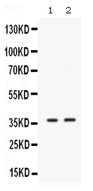 1 - Anti-SIX1 Picoband Antibody ABO12575