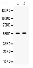 1 - Anti-GLUT9 Picoband Antibody ABO12577