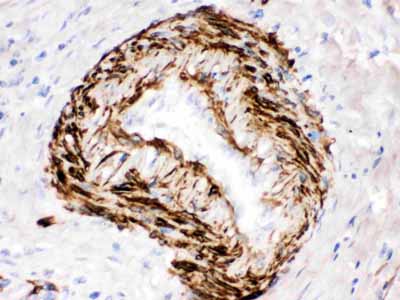 2 - Anti-SMYD3 Picoband Antibody ABO12579