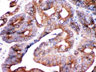 2 - Anti-SPTLC1 Picoband Antibody ABO12580