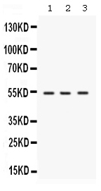 1 - Anti-SPTLC1 Picoband Antibody ABO12580