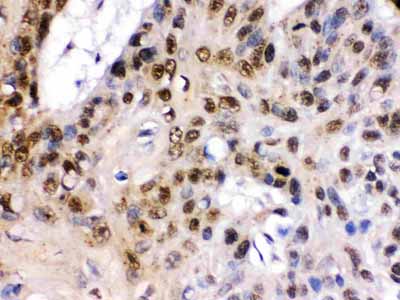 2 - Anti-TCF7L1 Picoband Antibody ABO12583