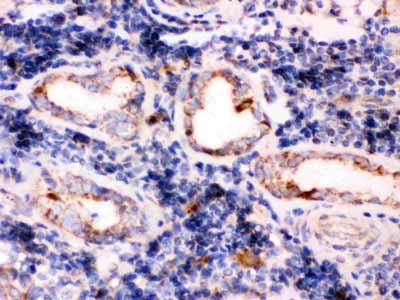 2 - Anti-TPP1 Picoband Antibody ABO12585