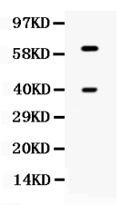 1 - Anti-TPP1 Picoband Antibody ABO12585