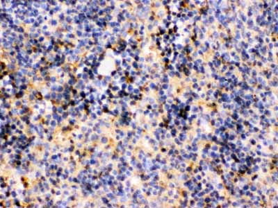 2 - Anti-TRIB2 Picoband Antibody ABO12586