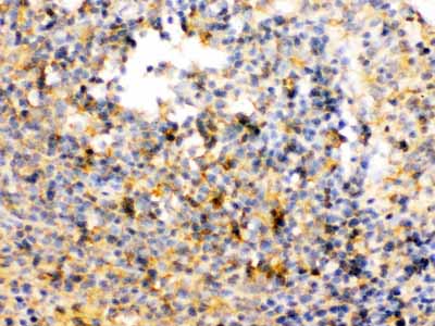2 - Anti-TRIB2 Picoband Antibody ABO12586