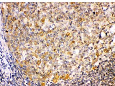 2 - Anti-TRIB2 Picoband Antibody ABO12586