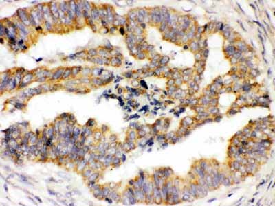 2 - Anti-TRPM4 Picoband Antibody ABO12588