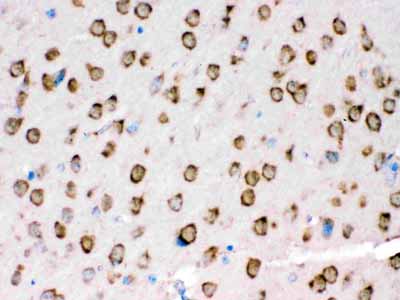 2 - Anti-TRPM5 Picoband Antibody ABO12589