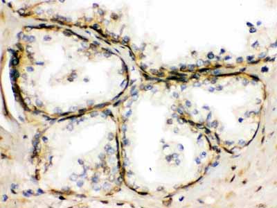 2 - Anti-TRPM5 Picoband Antibody ABO12589