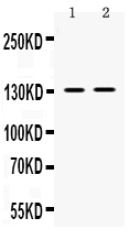 1 - Anti-TRPM5 Picoband Antibody ABO12589