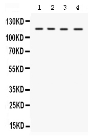 1 - Anti-UBA1 Picoband Antibody ABO12590