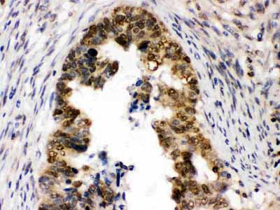 2 - Anti-UHRF1 Picoband Antibody ABO12591