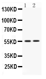 1 - Anti-VRK1 Picoband Antibody ABO12593
