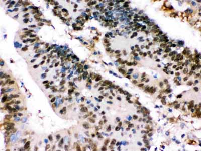 2 - Anti-XRCC4 Picoband Antibody ABO12594