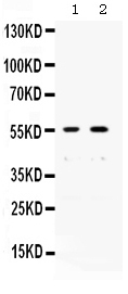 1 - Anti-XRCC4 Picoband Antibody ABO12594