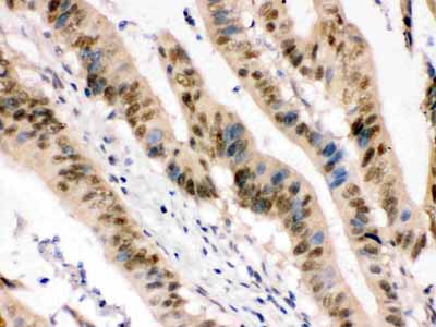 2 - Anti-ZBTB7A Picoband Antibody ABO12595