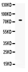 1 - Anti-ZBTB7A Picoband Antibody ABO12595