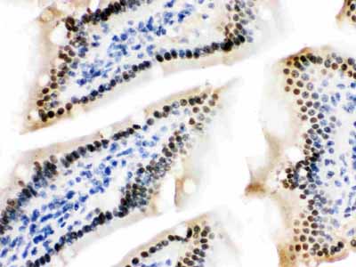 2 - Anti-ZBTB7A Picoband Antibody ABO12596