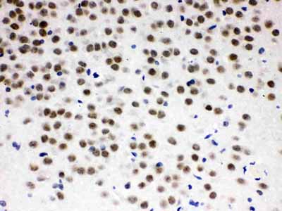 2 - Anti-ZBTB7A Picoband Antibody ABO12596