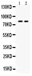 1 - Anti-ZP2 Picoband Antibody ABO12597
